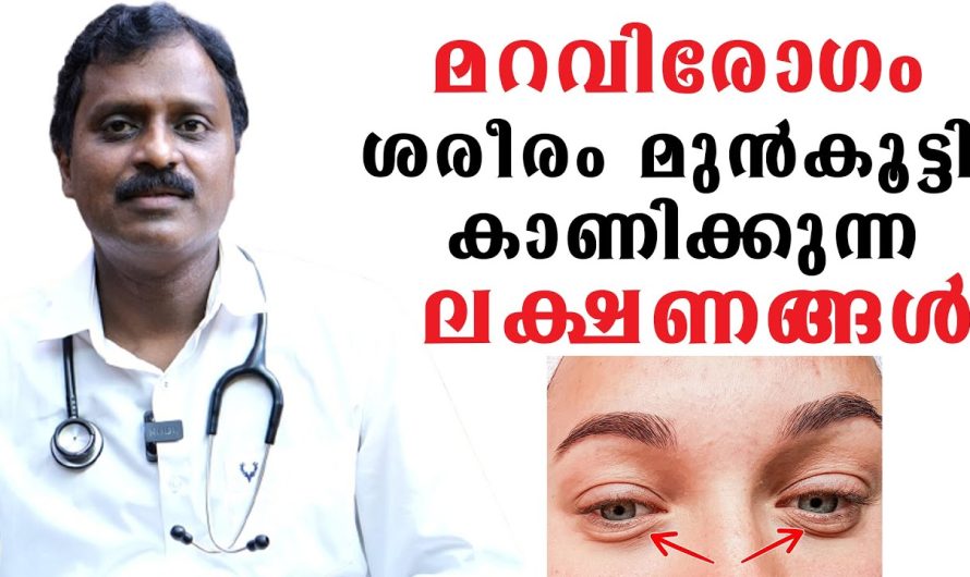 മറവിരോഗം ആർക്കെല്ലാമാണ് വരാൻ സാധ്യത ഉള്ളത്.. ഇതിന് പിന്നിലുള്ള പ്രധാന കാരണങ്ങൾ എന്തെല്ലാമാണ്..