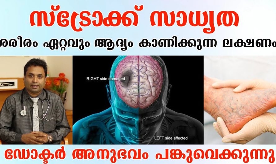 ശരീരത്തിൽ തളർച്ചയോടൊപ്പം ഈ പറയുന്ന നാല് ലക്ഷണങ്ങൾ കൂടി കണ്ടാൽ സ്ട്രോക്ക് സാധ്യതകൾ ആണോ എന്ന് പരിശോധിക്കണം…