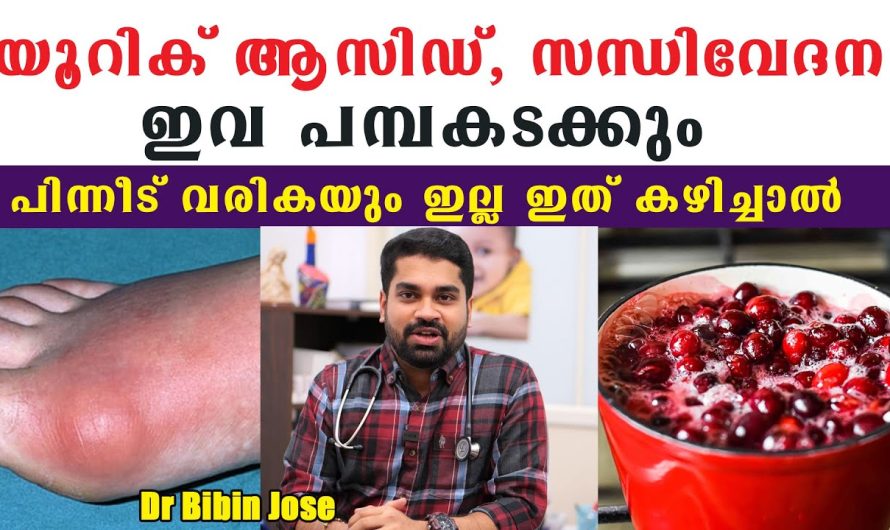 യൂറിക്കാസിഡ് ശരീരത്തിൽ വർദ്ധിക്കാതിരിക്കാൻ ആയിട്ട് ജീവിതശൈലിയിലും ഭക്ഷണ രീതിയിലും വരുത്തേണ്ട മാറ്റങ്ങൾ…