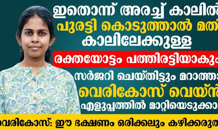 വെരിക്കോസ് വെയിൻ എന്നുള്ള പ്രശ്നം വരാതിരിക്കാനും ഈ ഒരു പ്രശ്നം സർജറി ഇല്ലാതെ പരിഹരിക്കാനുള്ള മാർഗങ്ങളെ കുറിച്ച് അറിയാം…