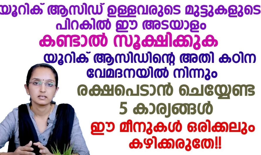 ഈ പറയുന്ന കാര്യങ്ങൾ ഭക്ഷണരീതികളിൽ ശ്രദ്ധിച്ചാൽ ശരീരത്തിൽ യൂറിക്കാസിഡ് കൂടുന്നത് നിയന്ത്രിക്കാം…