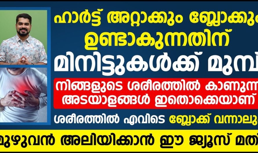 ഹാർട്ട് സംബന്ധമായ പ്രശ്നങ്ങളും ശരീരത്തിൽ ബ്ലോക്കുകളും ഉണ്ടാകാതിരിക്കാൻ ഭക്ഷണരീതിയിൽ ശ്രദ്ധിക്കേണ്ട കാര്യങ്ങൾ…