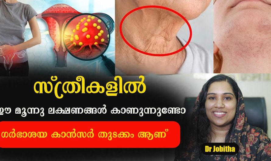 സ്ത്രീകളിൽ ഇലക്ഷണങ്ങൾ കാണാറുണ്ടോ??? അവഗണിക്കരുതേ… ഉറപ്പാണ് ക്യാൻസർ!