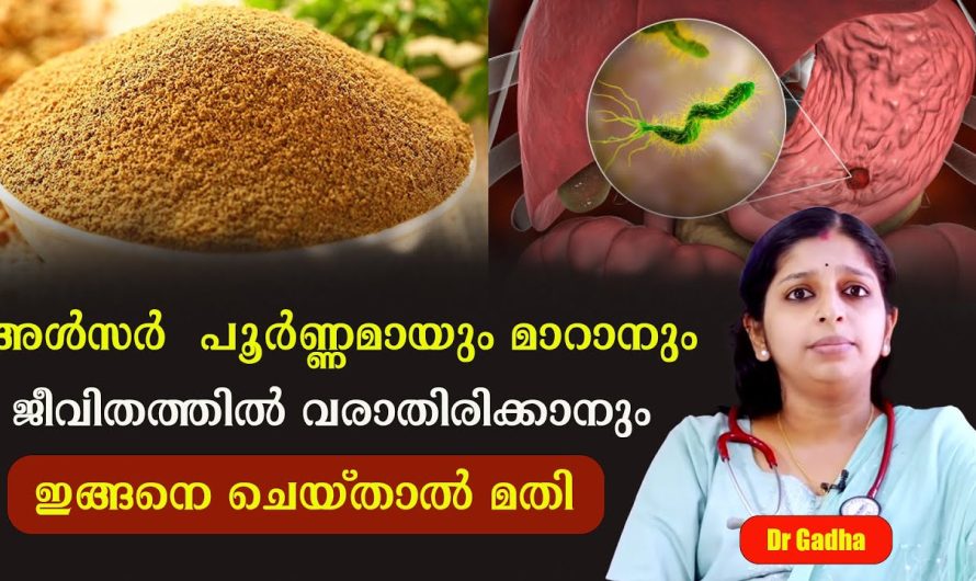 അൾസർ ജീവിതത്തിൽ നിന്നും പൂർണമായും അകറ്റണോ??? ഇങ്ങനെ ചെയ്താൽ മാത്രം മതി!