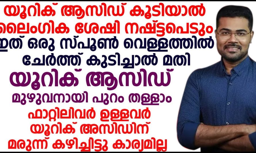 ഭക്ഷണരീതികളിൽ ഒരുപാട് മാറ്റങ്ങൾ വരുത്തിയിട്ടും ശരീരത്തിൽ യൂറിക്കാസിഡ് ലെവൽ കുറയുന്നില്ലെങ്കിൽ ഈ ഒരു കാര്യം ചെയ്താൽ മതി…