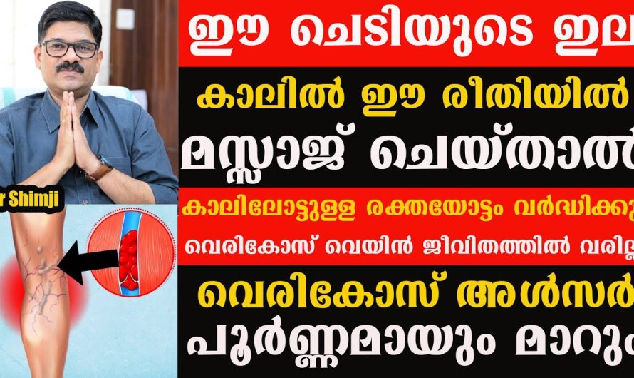 വെരിക്കോസ് അൾസറിനെ കുറിച്ച് അറിയുമോ??? ശ്രദ്ധിക്കുക ജീവന്റെ വിലയുള്ള ഇൻഫർമേഷൻ!