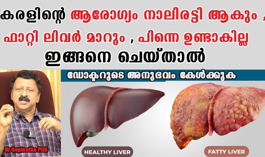 ഫാറ്റി ലിവർ മാറി കരളിന് ആരോഗ്യം 4 ഇരട്ടി കൂട്ടണോ?? ഇങ്ങനെ ചെയ്താൽ പിന്നീട് ഉണ്ടാകില്ല!