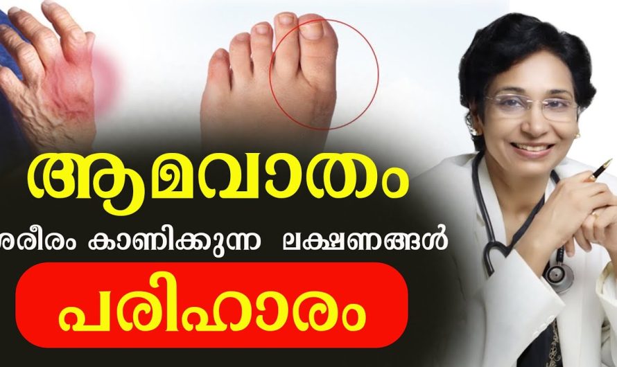 ഈ ലക്ഷണങ്ങൾ നിങ്ങളിൽ ഉണ്ടോ? ആമവാതത്തിന്റെ തുടക്കമാണ് ശ്രദ്ധിക്കുക!