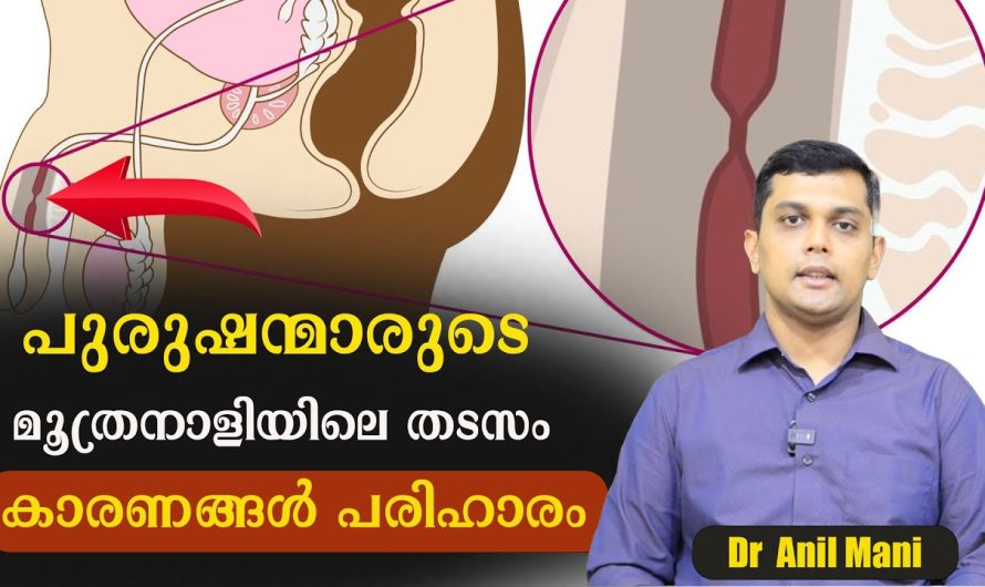 പുരുഷന്മാർക്ക് മൂത്രനാളിയിൽ  തടസ്സം അനുഭവപ്പെടുന്നുണ്ടോ??? കാരണം ഇതാണ്….