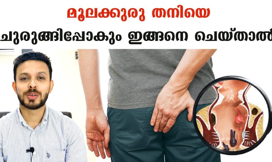 പൈൽസ് അഥവാ മൂലക്കുരു നിങ്ങൾക്കുണ്ടോ??? ഈ വീഡിയോ മറക്കാതെ കാണുക!