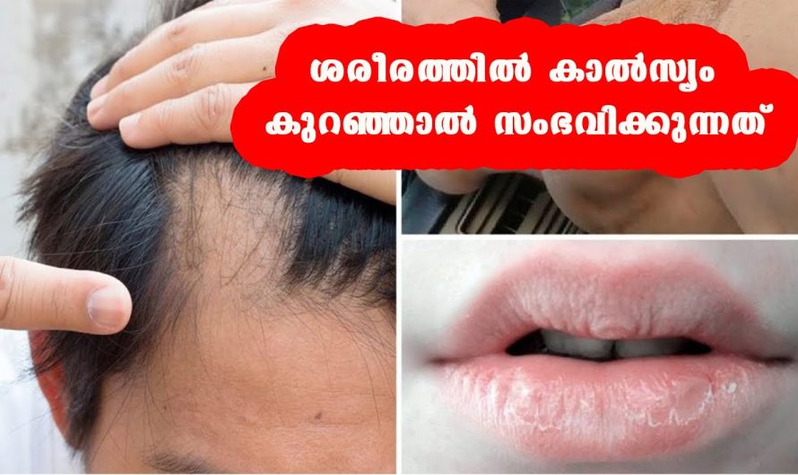 കാല്‍സ്യത്തിന്റെ അളവ് ശരീരത്തിൽ കുറഞ്ഞാൽ….