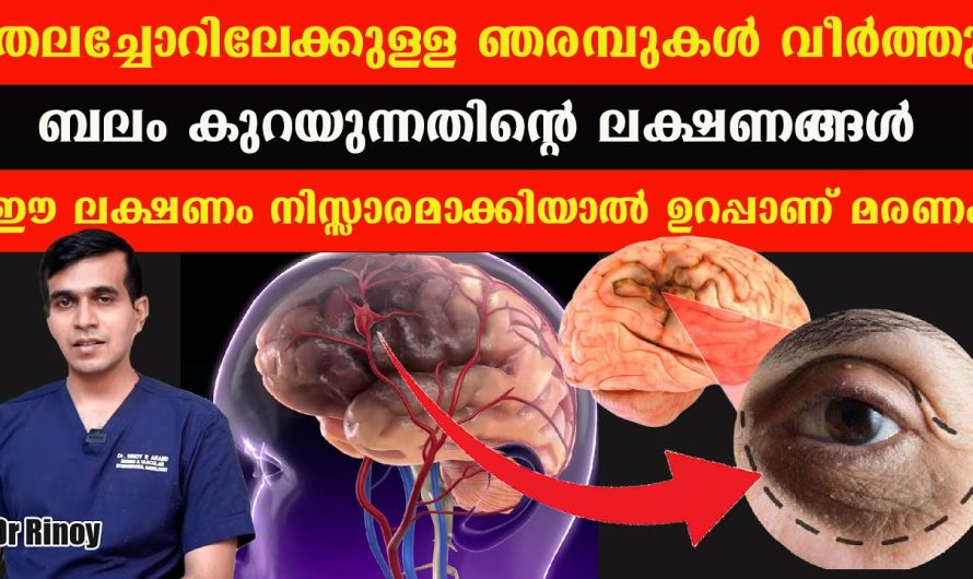 ഈ ലക്ഷണം നിസ്സാരമാക്കിയാൽ ഉറപ്പാണ് മരണം ശ്രദ്ധിക്കുക!