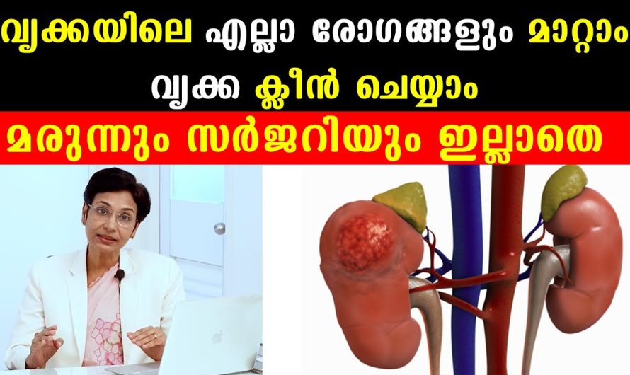 വൃക്ക സംബന്ധമായ എല്ലാ രോഗങ്ങളും മാറ്റണോ??? മരുന്നും സർജറിയും ഇല്ലാതെ!