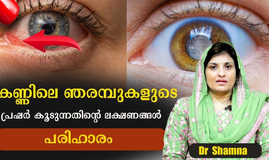 കണ്ണിലെ ഞരമ്പുകളുടെ പ്രഷർ കൂടുന്നതിന് ലക്ഷണങ്ങൾ! ശ്രദ്ധിക്കുക