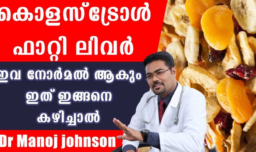 കൊളസ്ട്രോൾ ഫാറ്റിലിവർ എന്നിവ നോർമൽ ആകാൻ ചെയ്യേണ്ടത്!