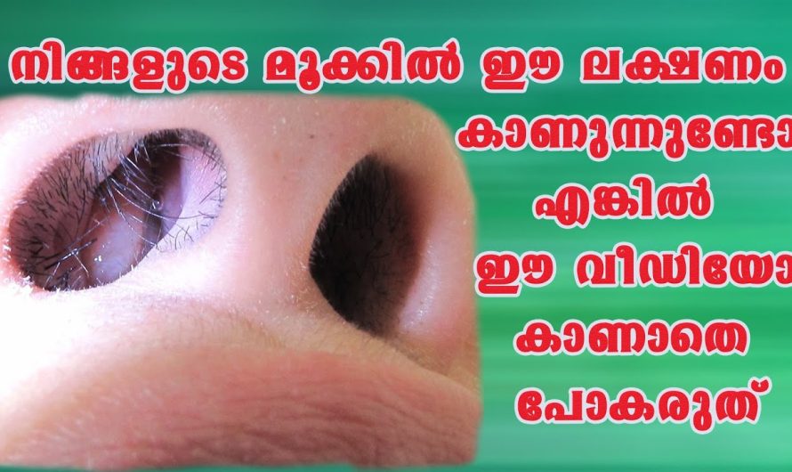 നിങ്ങളുടെ മൂക്കിൽ ഈ ലക്ഷണം കാണുന്നുണ്ടോ??  അവഗണിക്കരുത്!