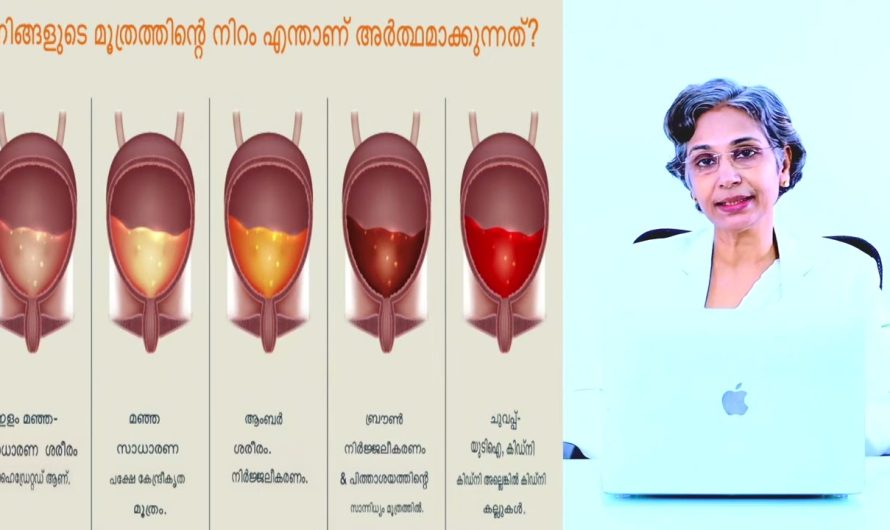 മൂത്രത്തിന്റെ നിറവ്യത്യാസം എന്തിനെ സൂചിപ്പിക്കുന്നു ?വീഡിയോ കാണാം