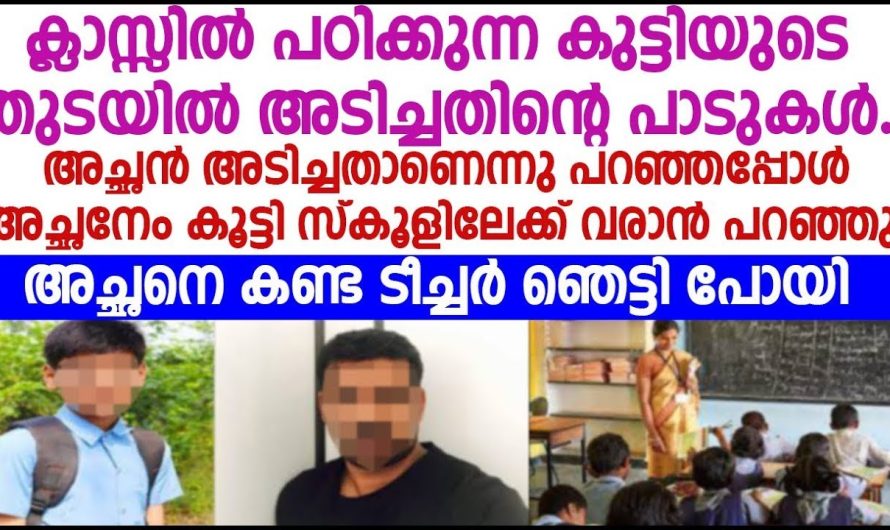 ക്ലാസിൽ പഠിക്കുന്ന കുട്ടിയുടെ തുടയിൽ അടിച്ചതിന്റെ പാടുകൾ ടീച്ചർ കുട്ടിയോട് അച്ഛനെയും കൂട്ടി സ്കൂളിലേക്ക് വരാൻ പറഞ്ഞു അച്ഛനെ കണ്ട ടീച്ചർ ഞെട്ടിപ്പോയി