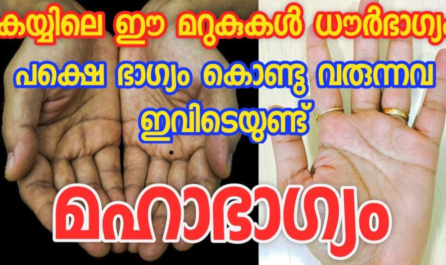 കൈയ്യിലെ ഈ മറുകുകള്‍ ശുഭസൂചകമോ അശുഭമോ മറുകിന്റെ സ്ഥാനം പറയും