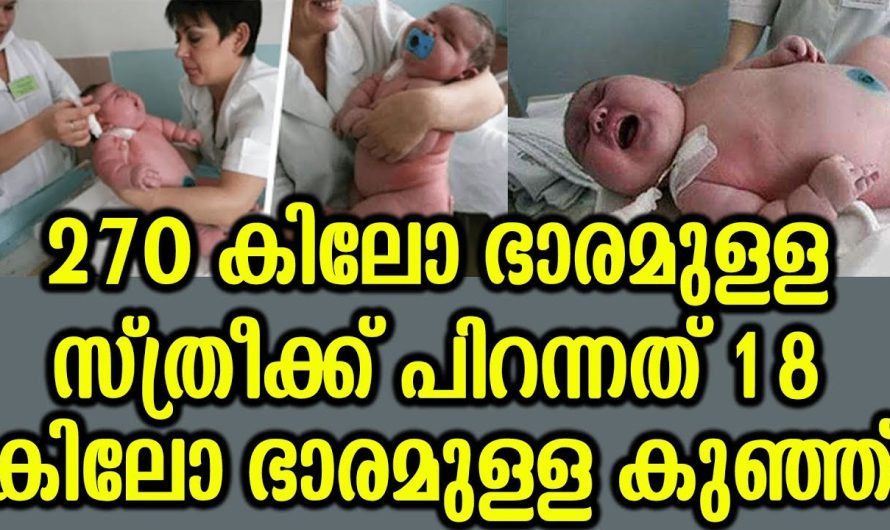 ഇരുനൂറ്റി എഴുപത് കിലോ ഭാരമുള്ള സ്‌ത്രീക്ക് പിറന്നത് പതിനെട്ട് കിലോ ഭാരമുള്ള കുഞ്ഞ്