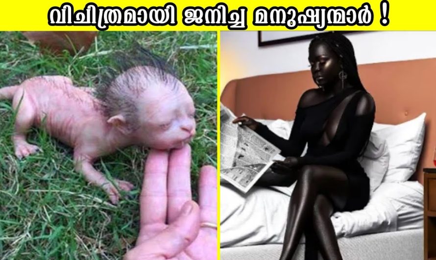 വിചിത്രരായി ജനിച്ച മനുഷ്യന്മാർ!