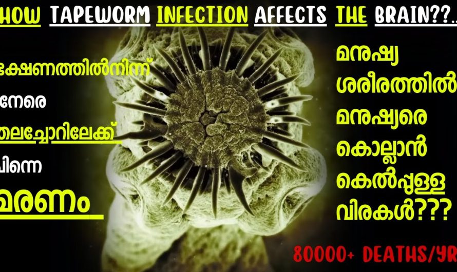 മനുഷ്യരുടെ ശരീരത്തിൽ മനുഷ്യരെ മുഴുവൻ ഇല്ലാതാക്കാൻ കെൽപ്പുള്ള വിരകൾ 😨