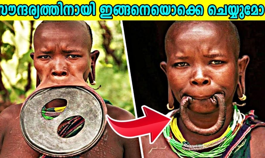 സൗന്ദര്യത്തിനായി ഇങ്ങനെയൊക്കെ ചെയ്യുന്ന മനുഷ്യർ ലോകത്തുണ്ട്