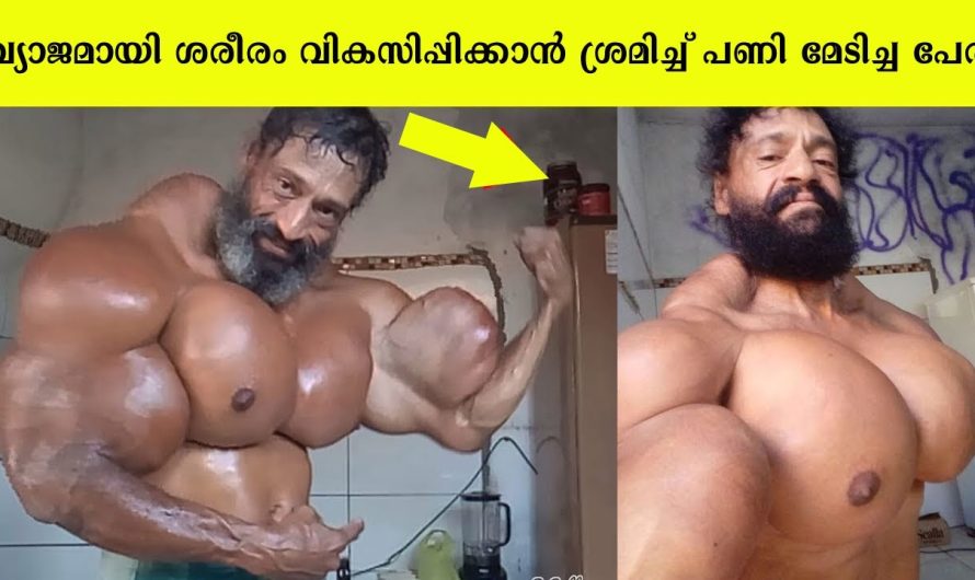 ബോഡി ബിൽഡിംഗ് അതിരുവിട്ടപ്പോൾ പണിപാളിയ ജിമ്മന്മാരെ കാണാം