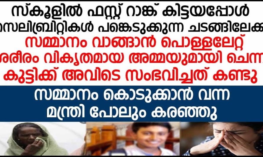 സമ്മാനം വാങ്ങാൻ പൊള്ളലേറ്റ് ശരീരം വികൃതമായ അമ്മയുമായി ചെന്ന് കുട്ടിക്ക് അവിടെ സംഭവിച്ചത്