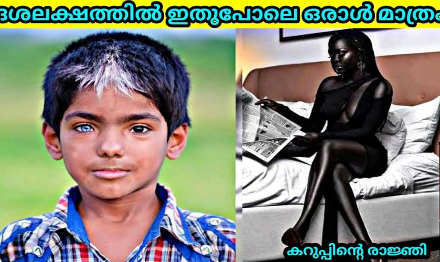 വിചിത്രമായ പ്രത്യേകതകൾ ഉള്ള മനുഷ്യർ