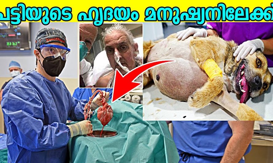അവിശ്വസനീയമായ ഹൃദയം മാറ്റിവയ്ക്കൽ ശസ്ത്രക്രിയ