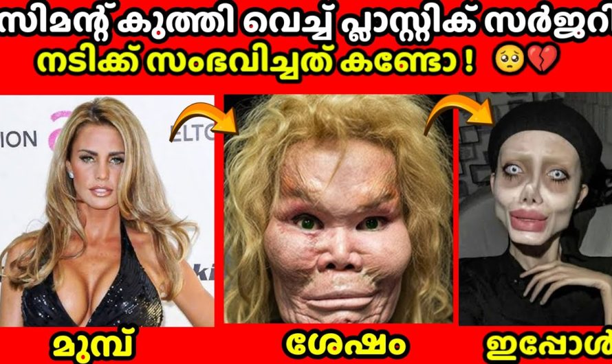 പ്ലാസ്റ്റിക് സർജറി ചെയ്ത നടിക്ക് സംഭവിച്ചത് 🥺💔