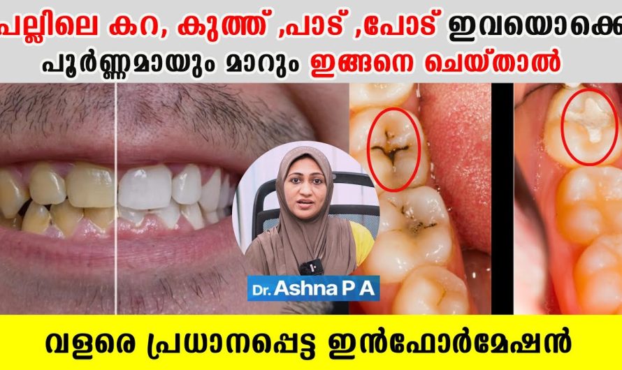 പല്ലിലെ കറ, കുത്ത് ,പാട് ,പോട് ഇവയൊക്കെ പൂര്‍ണ്ണമായും മാറും ഇങ്ങനെ ചെയ്താല്‍