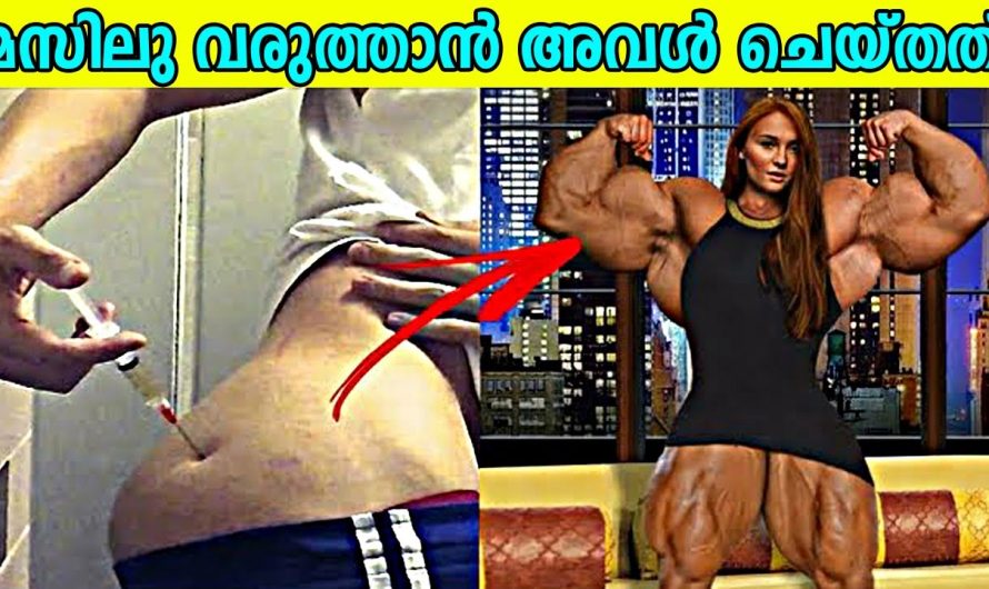 ഇഞ്ചക്ഷൻ കുത്തിവെച്ചു ശരീരമുണ്ടാക്കി , ഒടുവിൽ 254 ഓപ്പറേഷൻ വേണ്ടി വന്നു