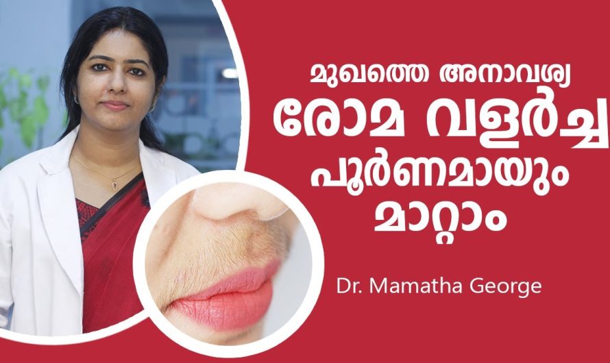 മുഖത്തെ രോമ വളർച്ച പൂർണമായും മാറ്റാം