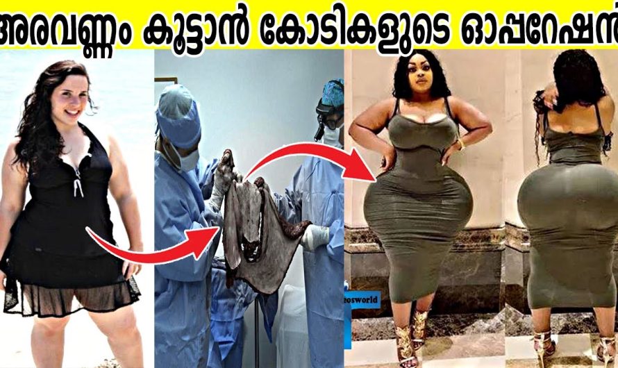 ഇങ്ങനെയും മനുഷ്യർ ലോകത്തുണ്ട്