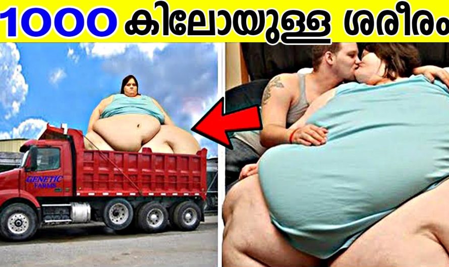 1000 കിലോ ശരീര ഭാരമുള്ള യുവതി