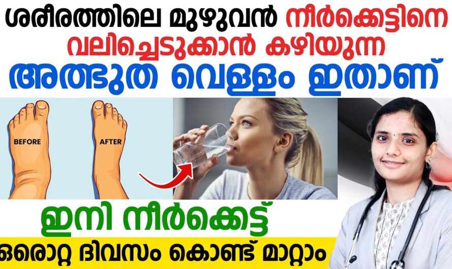 You can get rid of fluid retention in the body; try these techniques!