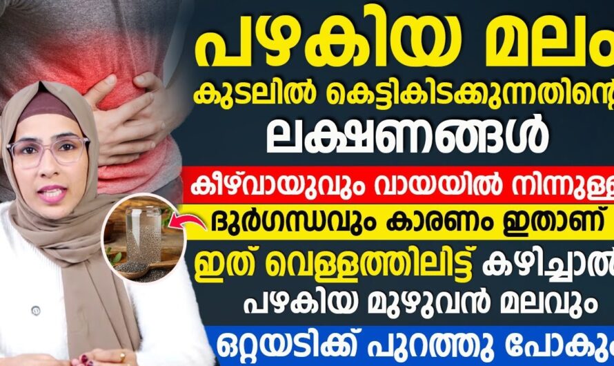 Do you have a bowel obstruction? Don’t ignore these symptoms!