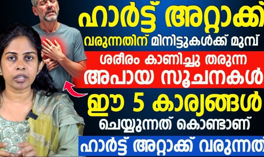 Symptoms of a heart attack