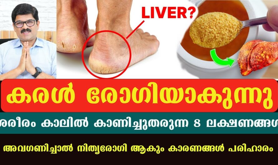 Is your liver in danger? Don’t ignore these signs your feet give you!