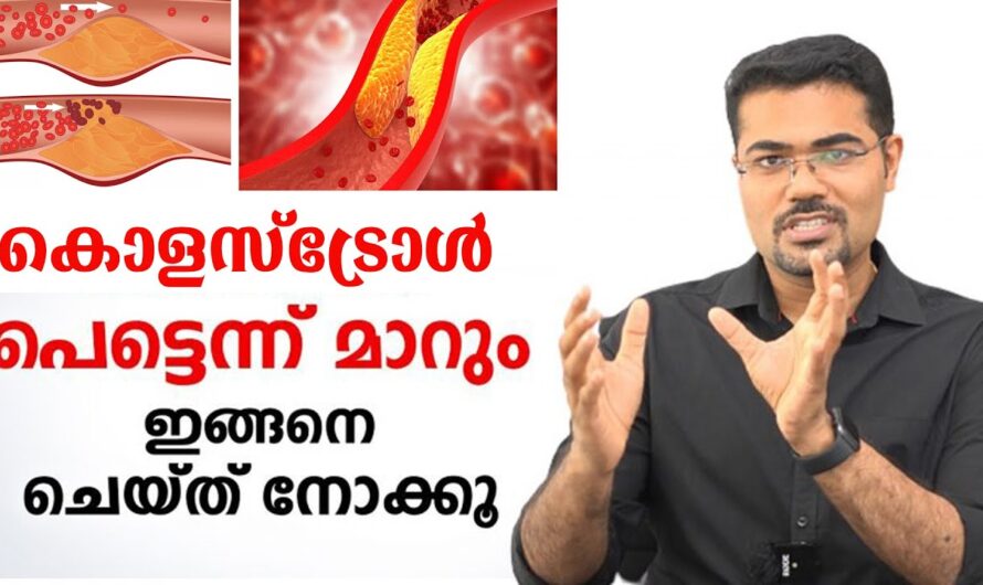 Why does cholesterol increase? Here are the main causes of bad cholesterol!