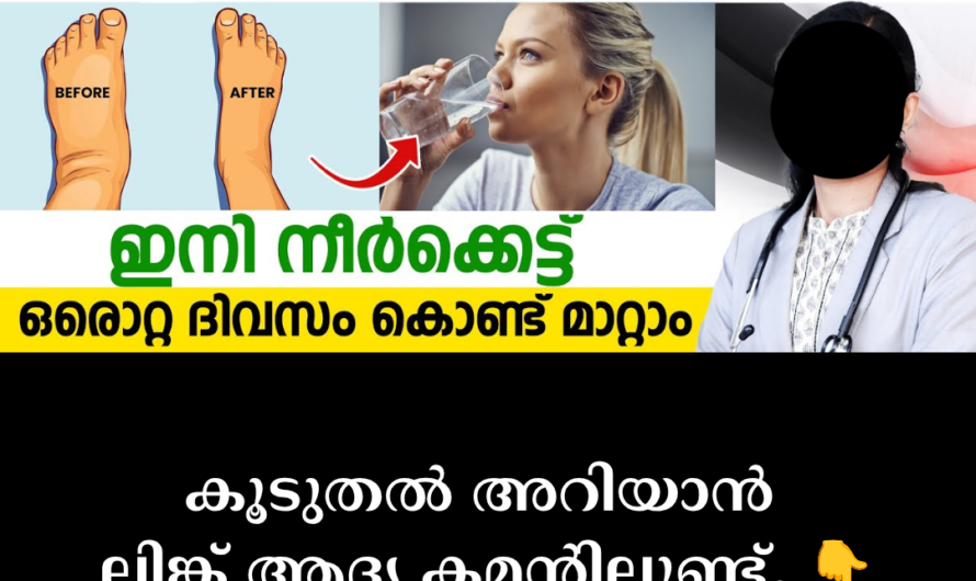 Severe swelling in the face and legs when you wake up in the morning! 5 main scientific reasons behind swelling all over the body