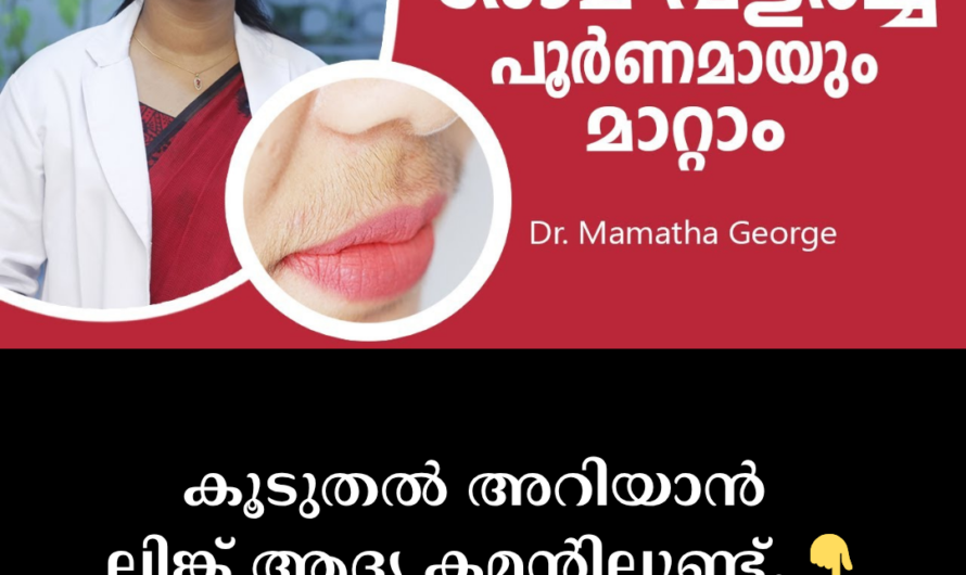 Reasons for excessive facial hair growth