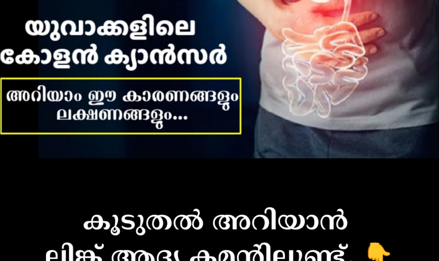 Main causes of colon cancer