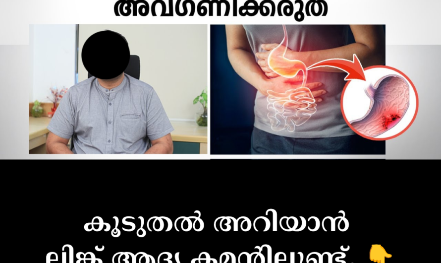 Although there is no single cause, the following factors increase the risk of developing stomach cancer: