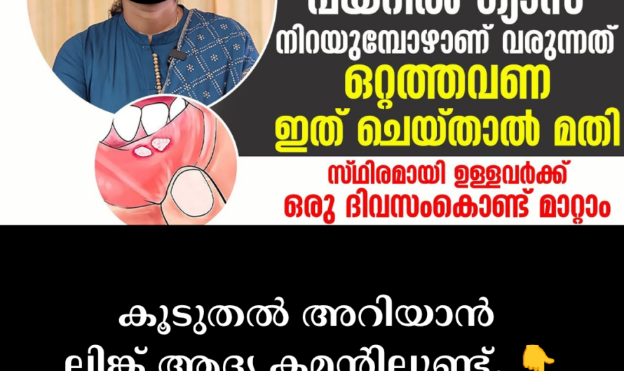 Reasons for mouth ulcers